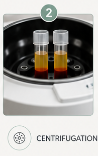 PRP PRF treatment at Sheffield Trichology Clinic (2 of 5)